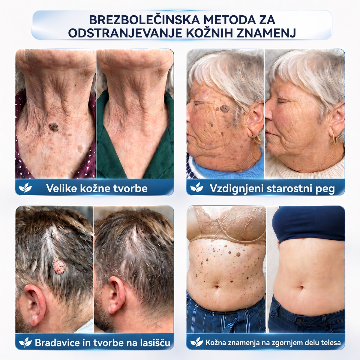 👩‍⚕️♥️ Vitalisys® 𝟕-𝐝𝐧𝐞𝐯𝐧𝐚 𝐤𝐫𝐞𝐦𝐚 𝐳𝐚 𝐨𝐝𝐬𝐭𝐫𝐚𝐧𝐣𝐞𝐯𝐚𝐧𝐣𝐞 𝐤𝐨ž𝐧𝐢𝐡 𝐢𝐳𝐫𝐚𝐬𝐭𝐤𝐨𝐯 𝐢𝐧 𝐦𝐚𝐝𝐞ž𝐞𝐯 (𝐍𝐞ž𝐧𝐚 𝐟𝐨𝐫𝐦𝐮𝐥𝐚 – 𝐛𝐫𝐞𝐳 𝐛𝐫𝐚𝐳𝐠𝐨𝐭𝐢𝐧) 👍🍈