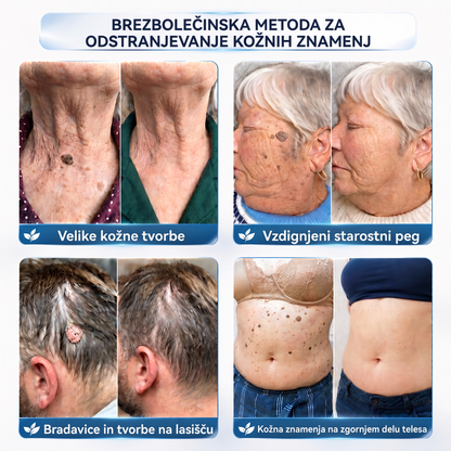 👩‍⚕️♥️ Vitalisys® 𝟕-𝐝𝐧𝐞𝐯𝐧𝐚 𝐤𝐫𝐞𝐦𝐚 𝐳𝐚 𝐨𝐝𝐬𝐭𝐫𝐚𝐧𝐣𝐞𝐯𝐚𝐧𝐣𝐞 𝐤𝐨ž𝐧𝐢𝐡 𝐢𝐳𝐫𝐚𝐬𝐭𝐤𝐨𝐯 𝐢𝐧 𝐦𝐚𝐝𝐞ž𝐞𝐯 (𝐍𝐞ž𝐧𝐚 𝐟𝐨𝐫𝐦𝐮𝐥𝐚 – 𝐛𝐫𝐞𝐳 𝐛𝐫𝐚𝐳𝐠𝐨𝐭𝐢𝐧) 👍🍈
