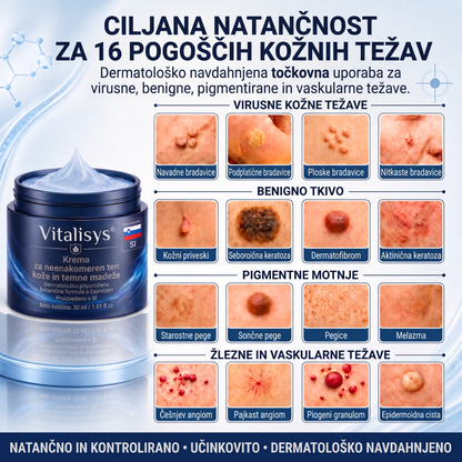 👩‍⚕️♥️ Vitalisys® 𝟕-𝐝𝐧𝐞𝐯𝐧𝐚 𝐤𝐫𝐞𝐦𝐚 𝐳𝐚 𝐨𝐝𝐬𝐭𝐫𝐚𝐧𝐣𝐞𝐯𝐚𝐧𝐣𝐞 𝐤𝐨ž𝐧𝐢𝐡 𝐢𝐳𝐫𝐚𝐬𝐭𝐤𝐨𝐯 𝐢𝐧 𝐦𝐚𝐝𝐞ž𝐞𝐯 (𝐍𝐞ž𝐧𝐚 𝐟𝐨𝐫𝐦𝐮𝐥𝐚 – 𝐛𝐫𝐞𝐳 𝐛𝐫𝐚𝐳𝐠𝐨𝐭𝐢𝐧) 👍🍈