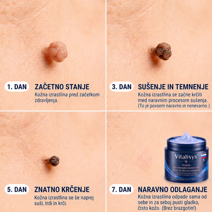 👩‍⚕️♥️ Vitalisys® 𝟕-𝐝𝐧𝐞𝐯𝐧𝐚 𝐤𝐫𝐞𝐦𝐚 𝐳𝐚 𝐨𝐝𝐬𝐭𝐫𝐚𝐧𝐣𝐞𝐯𝐚𝐧𝐣𝐞 𝐤𝐨ž𝐧𝐢𝐡 𝐢𝐳𝐫𝐚𝐬𝐭𝐤𝐨𝐯 𝐢𝐧 𝐦𝐚𝐝𝐞ž𝐞𝐯 (𝐍𝐞ž𝐧𝐚 𝐟𝐨𝐫𝐦𝐮𝐥𝐚 – 𝐛𝐫𝐞𝐳 𝐛𝐫𝐚𝐳𝐠𝐨𝐭𝐢𝐧) 👍🍈